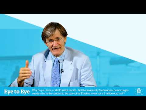 Eye to Eye: SMH Research Call