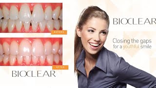 What is Bioclear ?