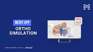 Medit App Ortho Simulation