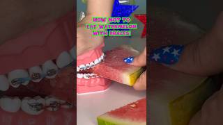 3 ways NOT to eat WATERMELON with BRACES *what to eat instead #braces #watermelon #summer
