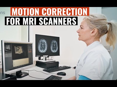 Tracoline : motion correction system for MRI scanners