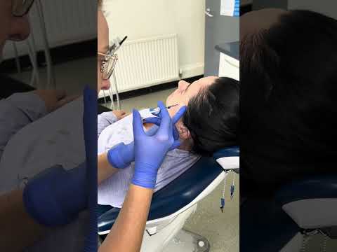 Wrinkle relaxing treatment - what to expect #wrinklerelaxing #facialaesthetics #dentist