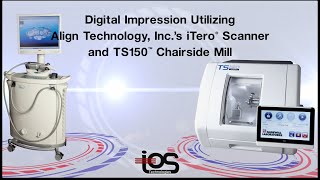Digital Impression Utilizing Align Technology, Inc.'s iTero Scanner and TS150 Chairside Mill