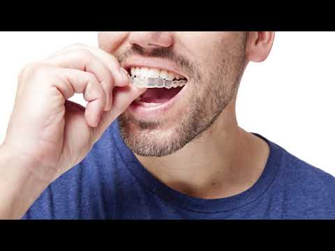FAQ - What is invisalign? | Matthew Nawrocki DMD, MS
