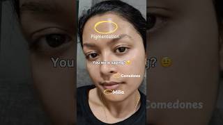 Skincare journey #oilyskincare #oilyskincareroutine #combinationskin #pigmentationsolution #kbeauty