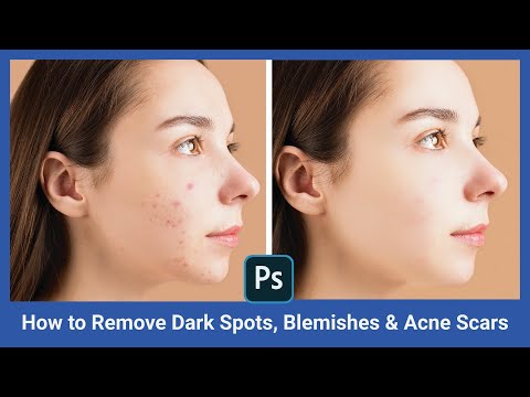 How to Remove Dark Spots, Blemishes & Acne Scars | Face Retouching | Photoshop Tutorial
