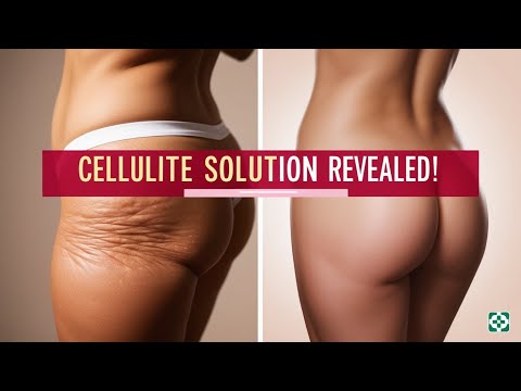 Get Rid of Cellulite FAST with These Proven Solutions