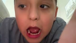 My tooth fall out