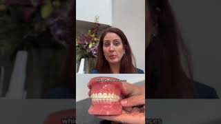 Invisalign or Braces? FAQ