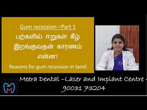 பற்களில் ஈறுகள் கீழே இறங்குகின்றதா? காரணம் என்ன தெரிந்து கொள்வோம்.Gum recession -Part 1