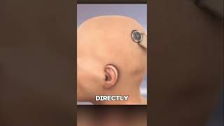How Neuralink Works in the Brain #short #fact #quickfacts #quickmind