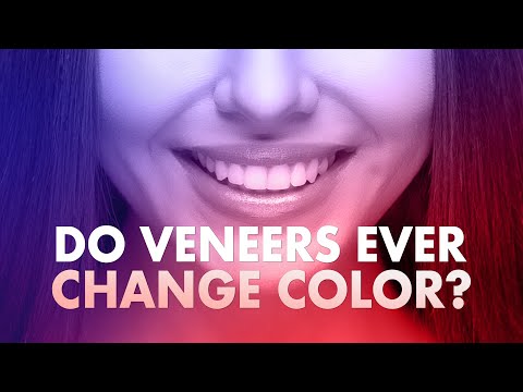 Do veneers ever change color?