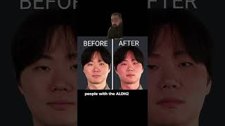 Doctor Explains Why Asians Go Red After Drinking!
