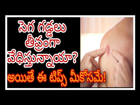 సెగ గడ్డలు తీవ్రంగా వేధిస్తున్నాయా?#heatboils #segagaddalu #summerhealthtips