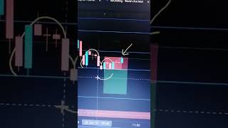 Nifty live trade Option #nifty #niftylivetradingtoday #nifty50 #livetrade #optionstrading #TraderB