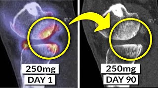 This Little-Known Herb Reduces Inflammation By 46% In 90 days