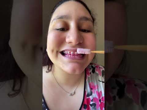 Orthodontic patient cleans teeth and braces #Shorts