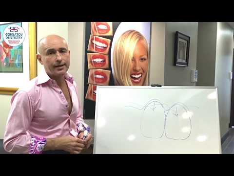 Керамические виниры в стоматологической клинике в Майами, Флорида США