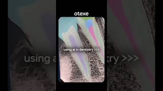 AI IN DENTISTRY🤖 #dental #dentist #dental #ai #aidentistry