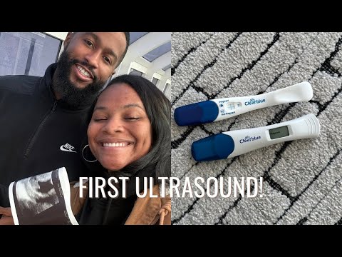 PREGNANCY VLOG: first appointments, symptoms and cravings