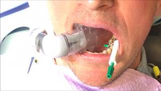 Biomimetic Dentistry- Dr. Alireza Panahpour