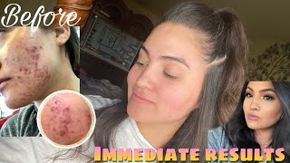 CUROLOGY REVIEW + SKINCARE ROUTINE | PICTURES INCLUDED