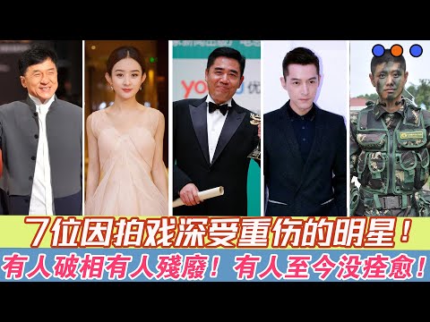 7位因拍戲深受重傷的明星，一位更比一位慘，有的至今沒痊癒！