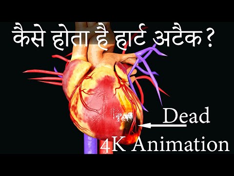 How heart attack kills #shorts