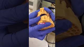 Digital Impression | Digital Dentistry | Partial Denture | Denture | 3D Scanner | Dental Technology