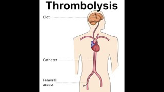 salpingolysis CPT code - simplify medical coding