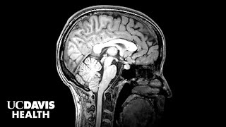 Study Finds Autistic Girls and Boys Show Key Differences in Brain Development |  UC Davis Health