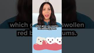 does scaling teeth damage your gums? #shorts