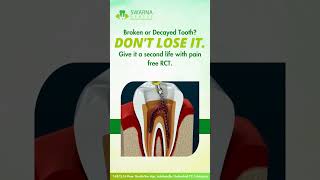 Save Your Tooth with Pain-Free RCT | A Second Chance at Smiling!