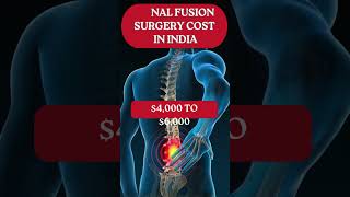 Why Americans Are Flying to India for Spinal Fusion Surgery?#costcomparison #spinalfusionsurgery