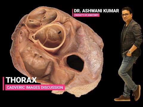 THORAX (Cadaveric images discussion)