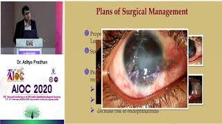 AIOC2020 - GP175 -B2b Series ( Back To Basics ) : Ocular Surface Surgeries