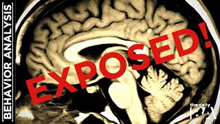 Right Brain vs. Left Brain Personality (MYTH EXPOSED)