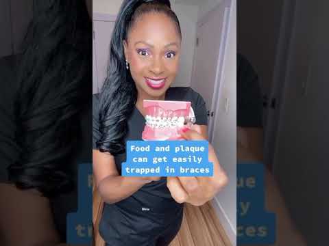 How to get a good checkup from your #orthodontist :) #Shorts