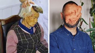 15 Most Shocking People Who Shouldn't Exist | UNREAL HUMANS