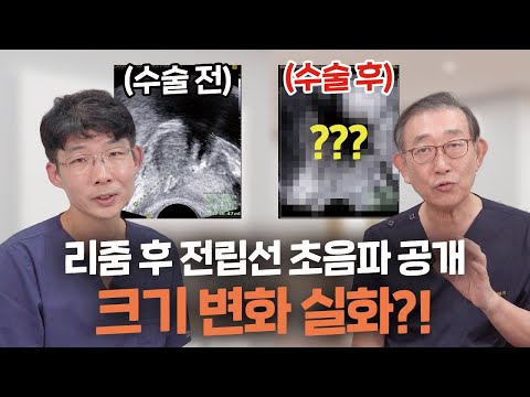 전립선 크기 줄었다?! 리줌 수술 전후 비교
