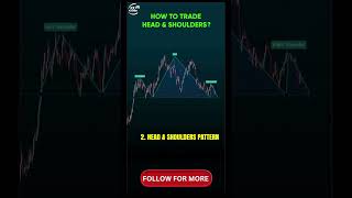 The only pattern you need for price reversals: Head and Shoulders strategy!