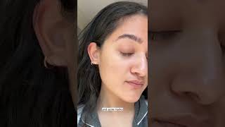 This is what REAL skin looks like