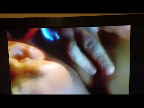 Doc on boxing epic