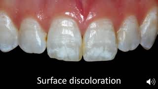 Case selection for micro abrasion