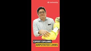 Here's what happens to amputated limbs