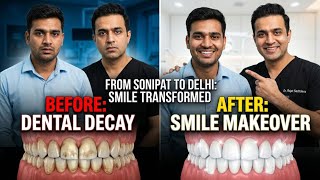 From Sonipat to Delhi for a Smile Makeover ✨ | Best Dentist Delhi | Dr. Rajat Sachdeva