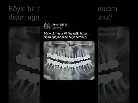 Böyle bir hasta kliniğe gelip hocam dişim ağrıyor dese ne yaparsınız? #werhat #dişhekimi #diyarbakır