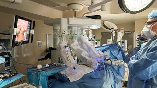 Staten Island University Hospital Begins Robotic Cardiac Surgery Program