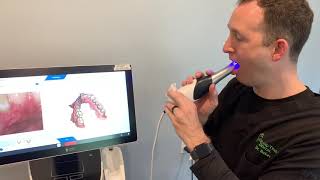 Fastest 3D Digital Impression of the Whole Mouth - CEREC Primescan