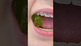 Can Your Orthodontist REALLY Tell How You Broke Off Your Bracket? 🤔 #braces